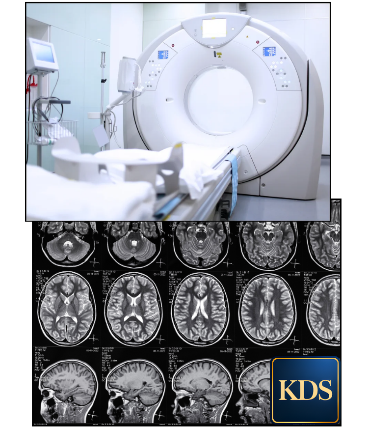 traumatic brain injury mri diagnosis nyc kds law